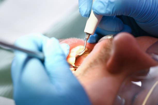 Best Cosmetic Emergency Dentistry in Saks, AL
